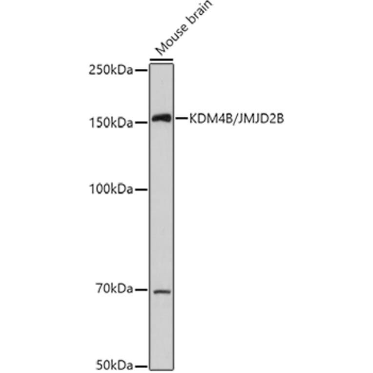 Western Blot - Anti-KDM4B/JMJD2B Antibody (A14999) - Antibodies.com