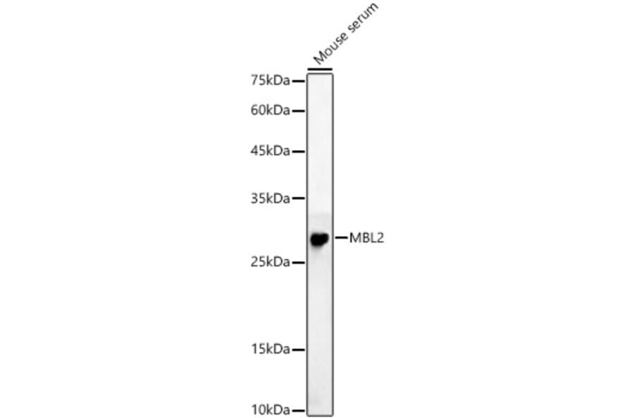 Western Blot - Anti-Mannan Binding Lectin/MBL Antibody (A15000) - Antibodies.com