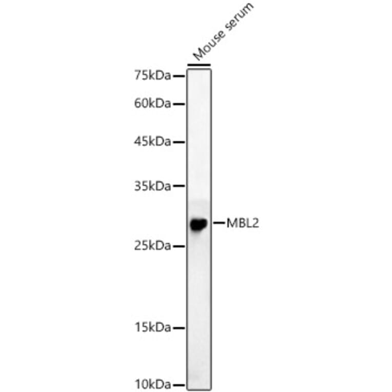 Western Blot - Anti-Mannan Binding Lectin/MBL Antibody (A15000) - Antibodies.com
