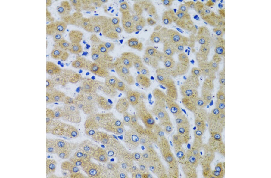 Immunohistochemistry - Anti-Mannan Binding Lectin/MBL Antibody (A15000) - Antibodies.com