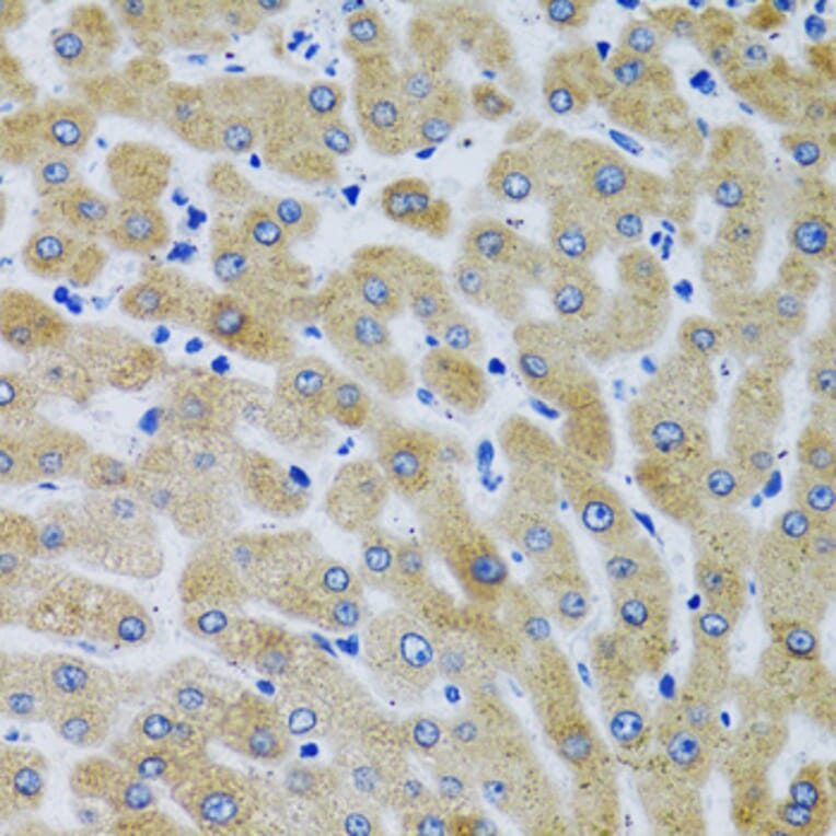 Immunohistochemistry - Anti-Mannan Binding Lectin/MBL Antibody (A15000) - Antibodies.com