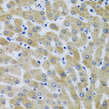 Immunohistochemistry - Anti-Mannan Binding Lectin/MBL Antibody (A15000) - Antibodies.com