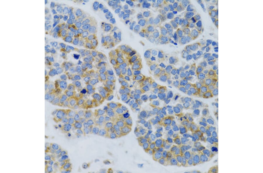 Immunohistochemistry - Anti-Mannan Binding Lectin/MBL Antibody (A15000) - Antibodies.com