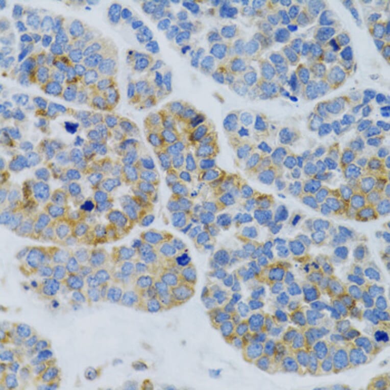 Immunohistochemistry - Anti-Mannan Binding Lectin/MBL Antibody (A15000) - Antibodies.com