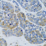 Immunohistochemistry - Anti-Mannan Binding Lectin/MBL Antibody (A15000) - Antibodies.com