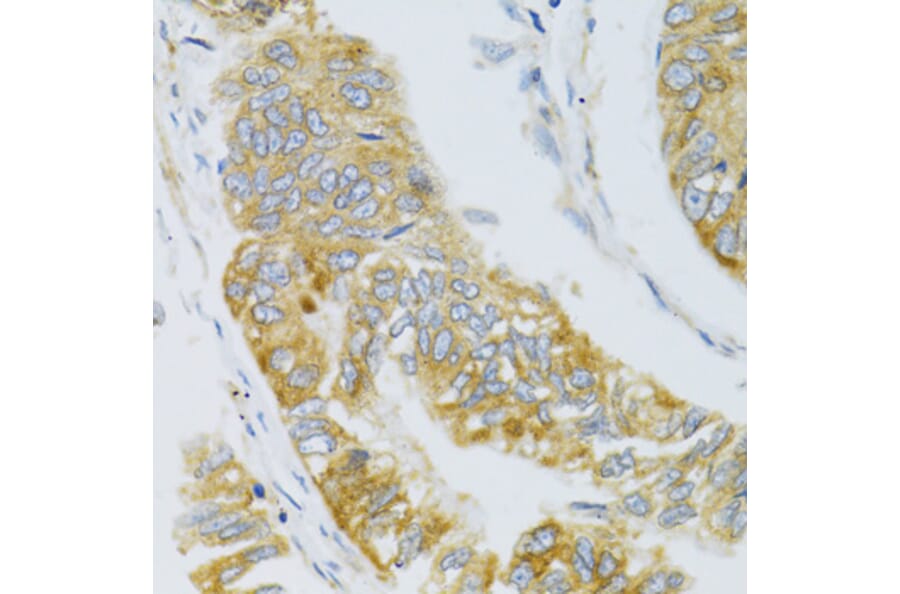 Immunohistochemistry - Anti-Mannan Binding Lectin/MBL Antibody (A15000) - Antibodies.com