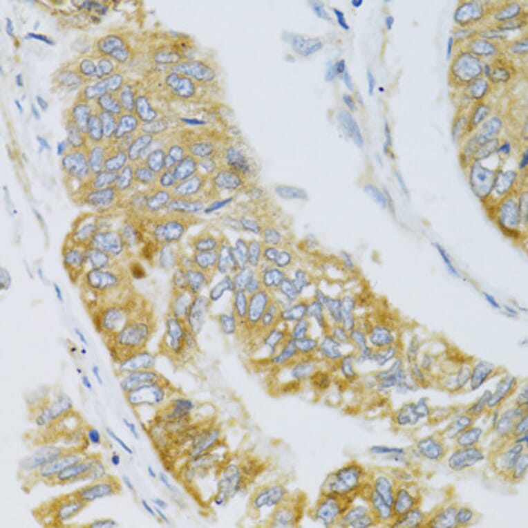 Immunohistochemistry - Anti-Mannan Binding Lectin/MBL Antibody (A15000) - Antibodies.com
