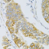 Immunohistochemistry - Anti-Mannan Binding Lectin/MBL Antibody (A15000) - Antibodies.com
