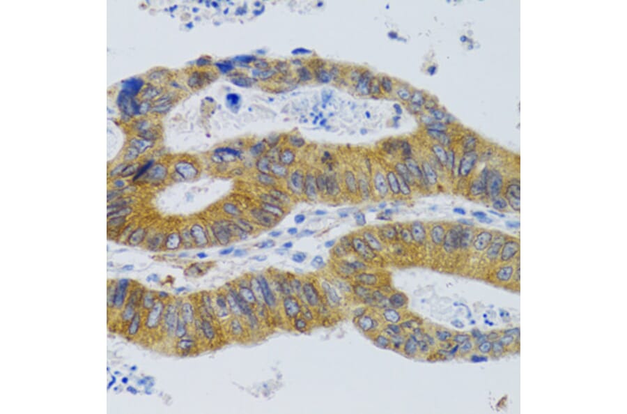 Immunohistochemistry - Anti-Mannan Binding Lectin/MBL Antibody (A15000) - Antibodies.com