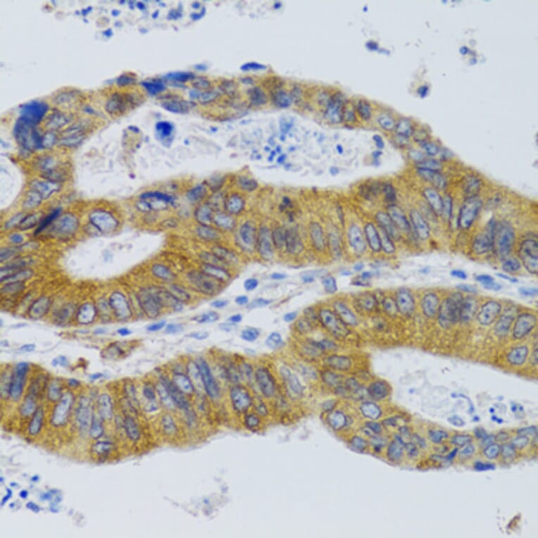 Immunohistochemistry - Anti-Mannan Binding Lectin/MBL Antibody (A15000) - Antibodies.com