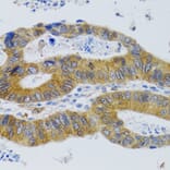 Immunohistochemistry - Anti-Mannan Binding Lectin/MBL Antibody (A15000) - Antibodies.com