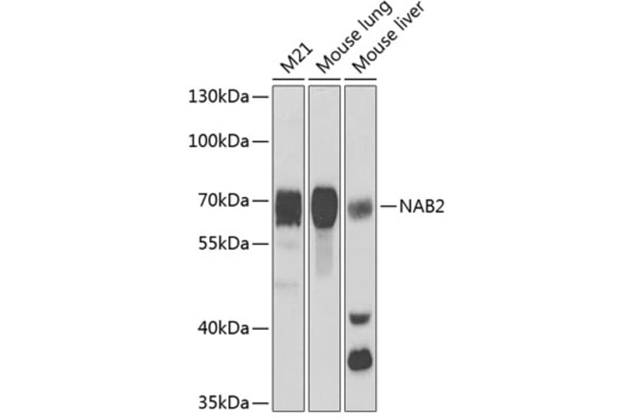 Western Blot - Anti-NAB2 Antibody (A15001) - Antibodies.com