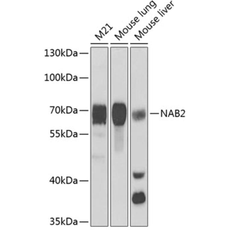 Western Blot - Anti-NAB2 Antibody (A15001) - Antibodies.com