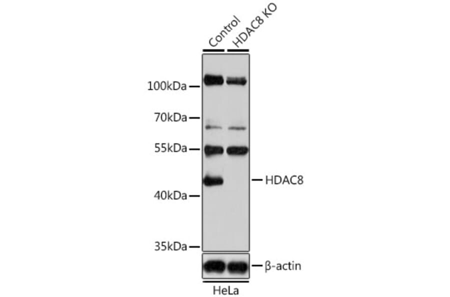 Western Blot - Anti-HDAC8 Antibody (A15002) - Antibodies.com