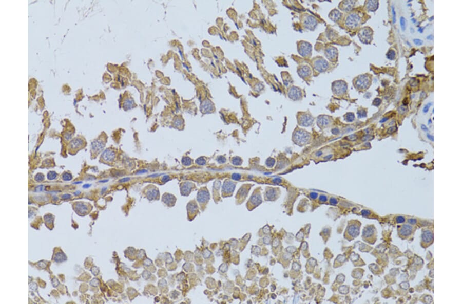 Immunohistochemistry - Anti-HDAC8 Antibody (A15002) - Antibodies.com
