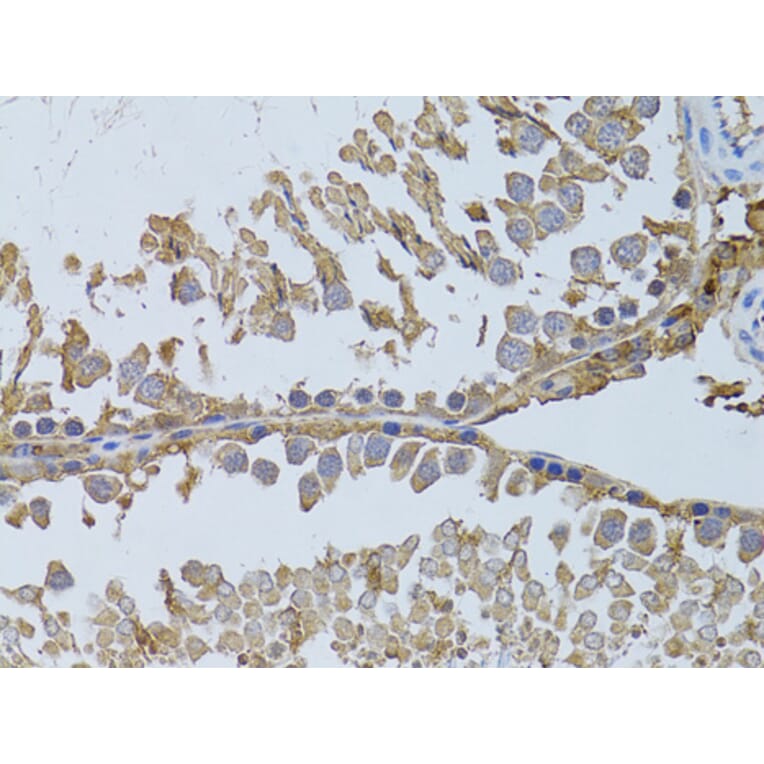 Immunohistochemistry - Anti-HDAC8 Antibody (A15002) - Antibodies.com