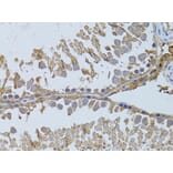 Immunohistochemistry - Anti-HDAC8 Antibody (A15002) - Antibodies.com
