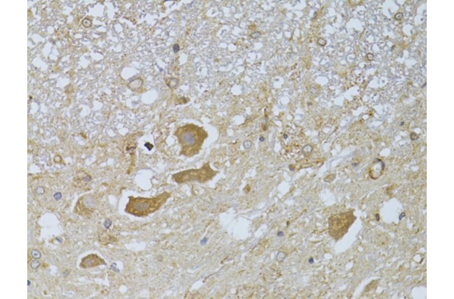 Immunohistochemistry - Anti-HDAC8 Antibody (A15002) - Antibodies.com