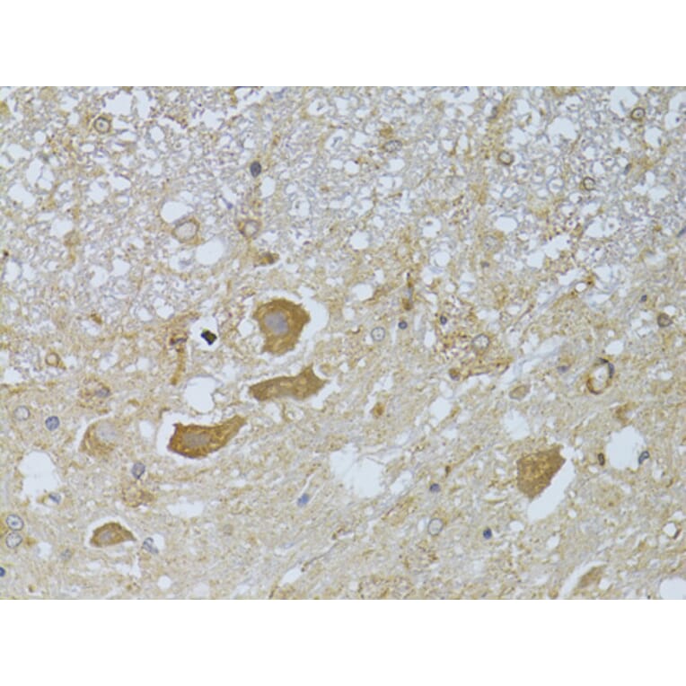 Immunohistochemistry - Anti-HDAC8 Antibody (A15002) - Antibodies.com