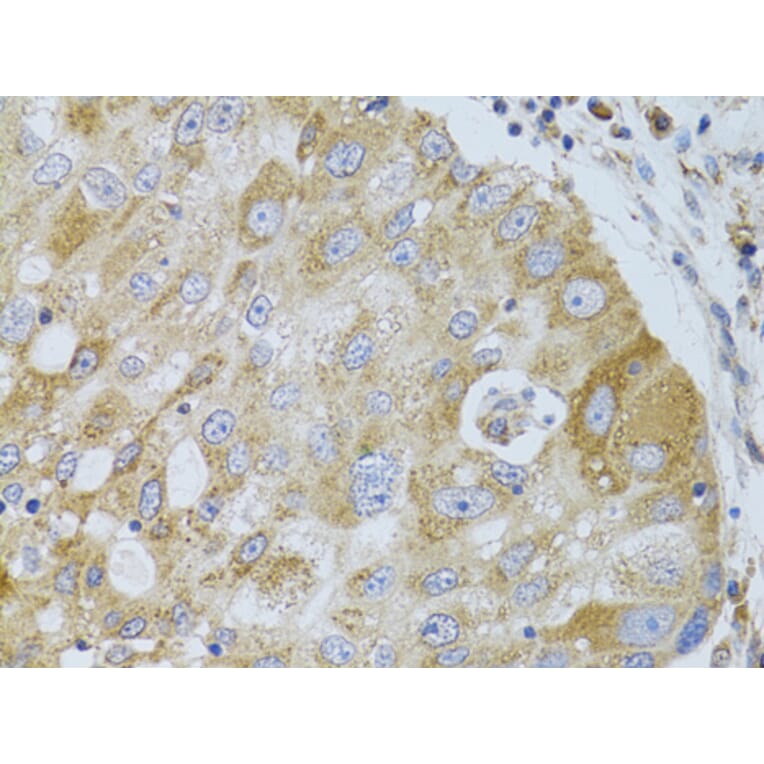 Immunohistochemistry - Anti-HDAC8 Antibody (A15002) - Antibodies.com