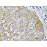 Immunohistochemistry - Anti-HDAC8 Antibody (A15002) - Antibodies.com
