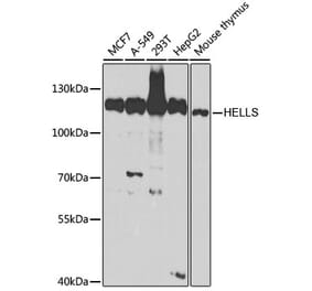 Western Blot - Anti-SMARCA6 Antibody (A15003) - Antibodies.com