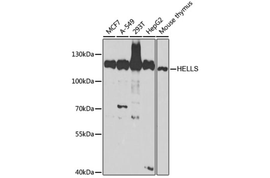 Western Blot - Anti-SMARCA6 Antibody (A15003) - Antibodies.com