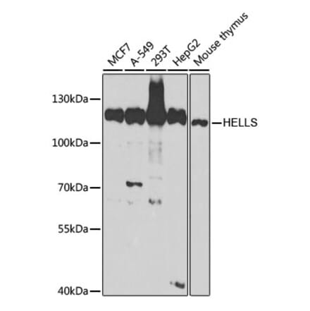 Western Blot - Anti-SMARCA6 Antibody (A15003) - Antibodies.com