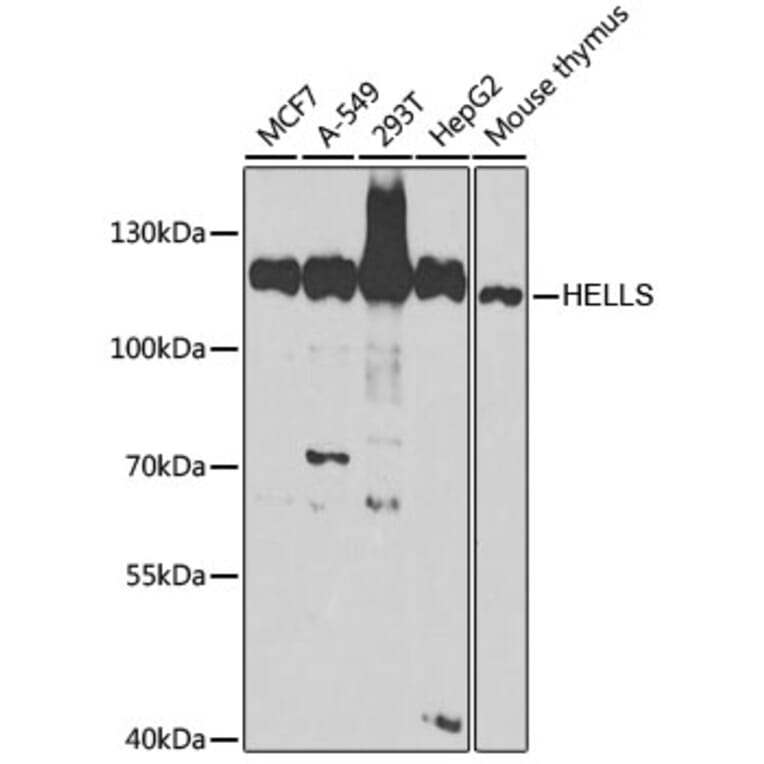 Western Blot - Anti-SMARCA6 Antibody (A15003) - Antibodies.com