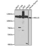 Western Blot - Anti-SMARCA6 Antibody (A15003) - Antibodies.com