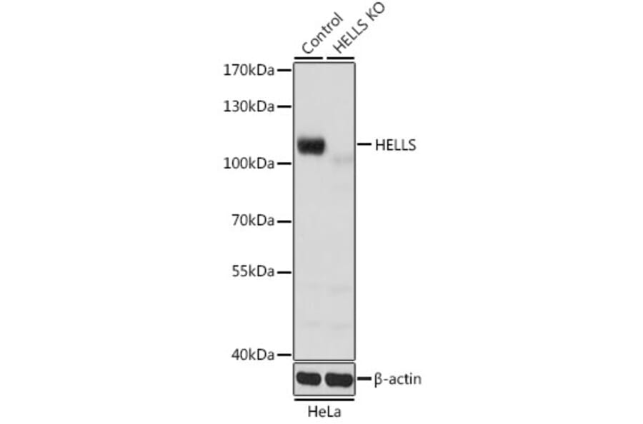 Western Blot - Anti-SMARCA6 Antibody (A15003) - Antibodies.com