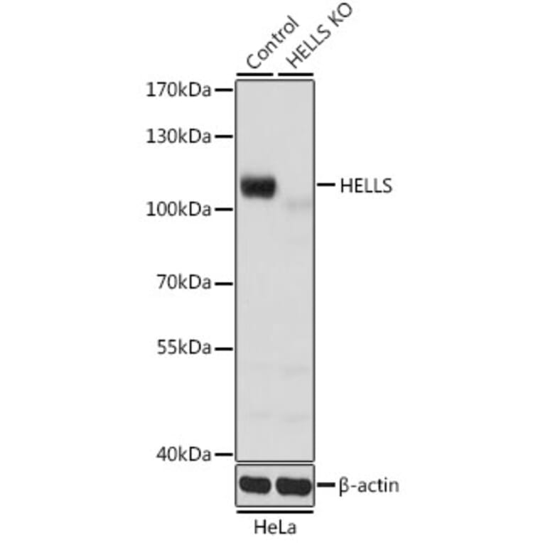 Western Blot - Anti-SMARCA6 Antibody (A15003) - Antibodies.com