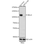 Western Blot - Anti-SMARCA6 Antibody (A15003) - Antibodies.com