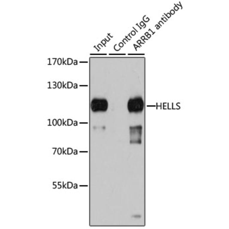 Western Blot - Anti-SMARCA6 Antibody (A15003) - Antibodies.com