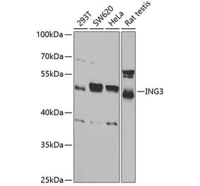 Western Blot - Anti-ING3 Antibody (A15004) - Antibodies.com