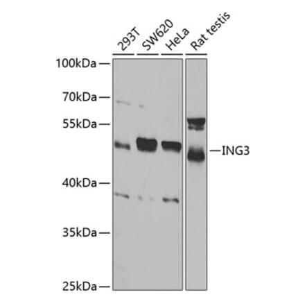 Western Blot - Anti-ING3 Antibody (A15004) - Antibodies.com