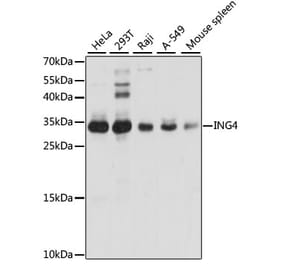 Western Blot - Anti-ING4 Antibody (A15005) - Antibodies.com