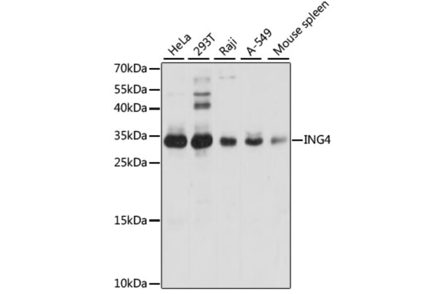 Western Blot - Anti-ING4 Antibody (A15005) - Antibodies.com