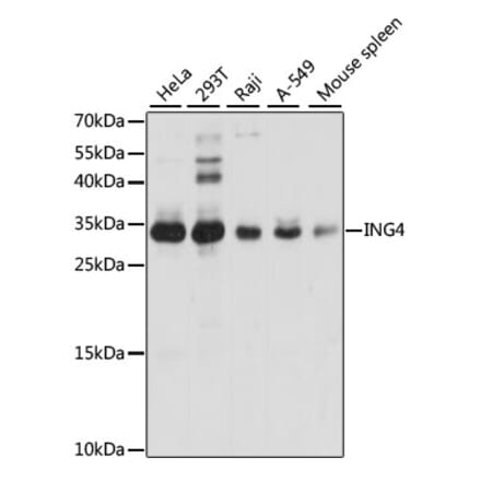 Western Blot - Anti-ING4 Antibody (A15005) - Antibodies.com