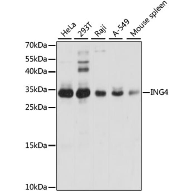 Western Blot - Anti-ING4 Antibody (A15005) - Antibodies.com