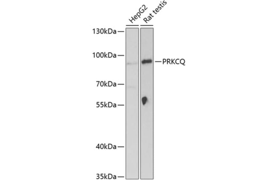 Western Blot - Anti-PKC theta/PRKCQ Antibody (A15006) - Antibodies.com