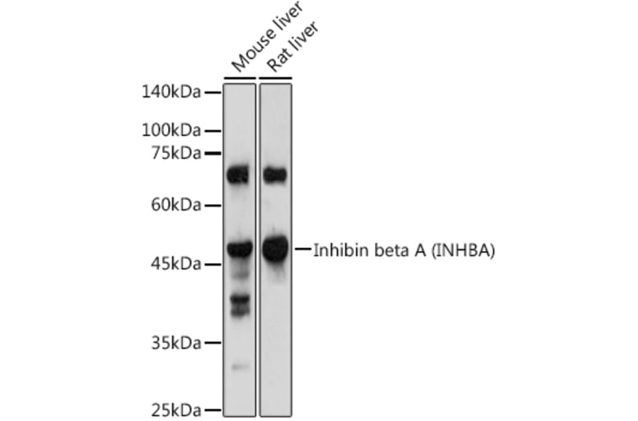 Western Blot - Anti-Inhibin beta A Antibody (A15007) - Antibodies.com