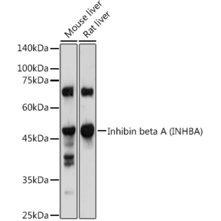 Western Blot - Anti-Inhibin beta A Antibody (A15007) - Antibodies.com