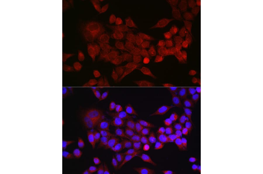 Immunofluorescence - Anti-Inhibin beta A Antibody (A15007) - Antibodies.com