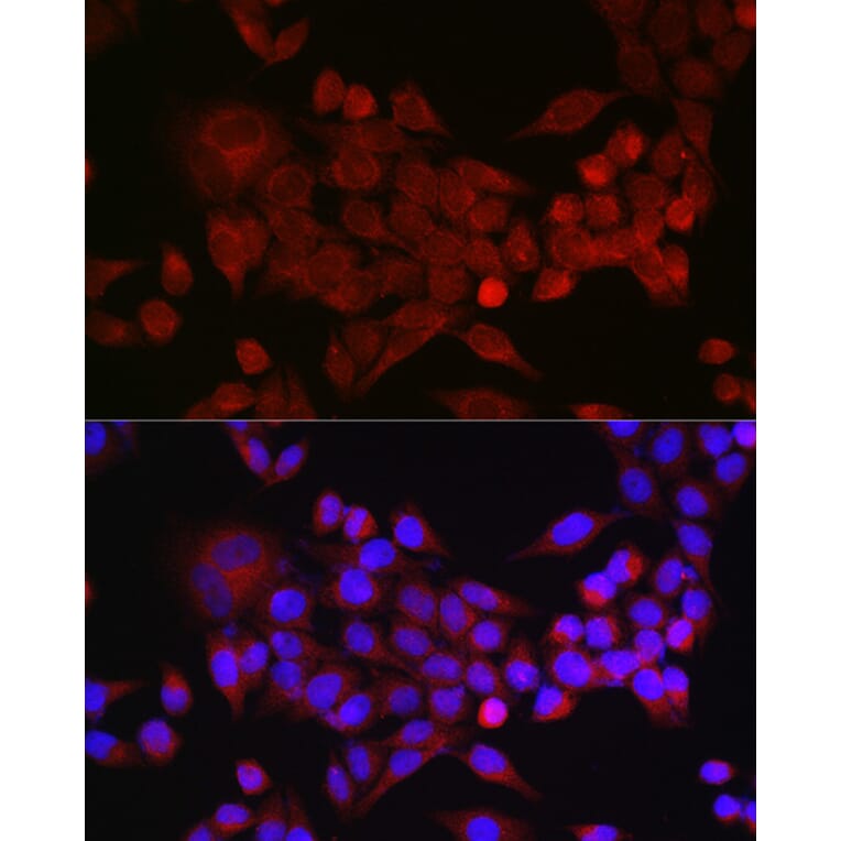 Immunofluorescence - Anti-Inhibin beta A Antibody (A15007) - Antibodies.com