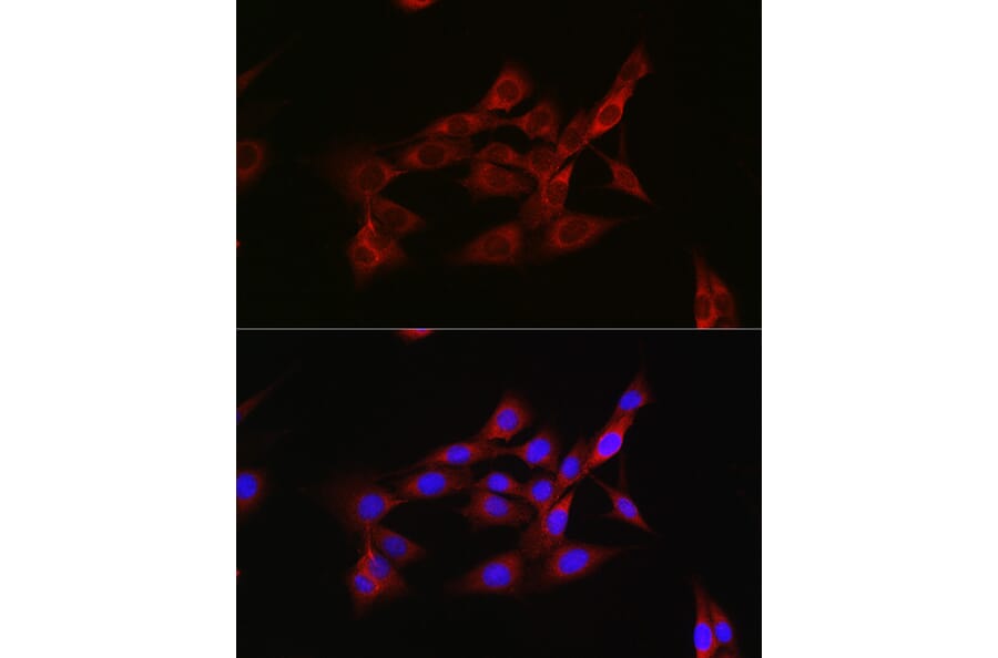 Immunofluorescence - Anti-Inhibin beta A Antibody (A15007) - Antibodies.com