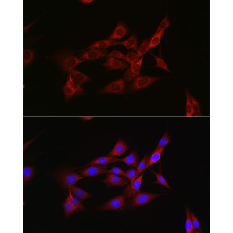 Immunofluorescence - Anti-Inhibin beta A Antibody (A15007) - Antibodies.com