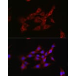 Immunofluorescence - Anti-Inhibin beta A Antibody (A15007) - Antibodies.com