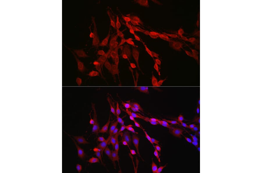 Immunofluorescence - Anti-Inhibin beta A Antibody (A15007) - Antibodies.com