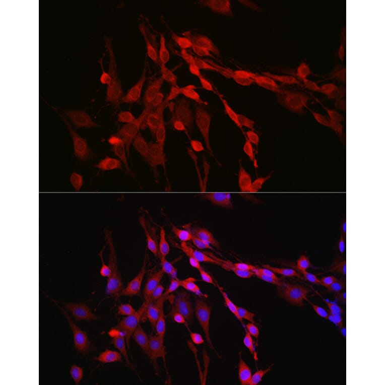 Immunofluorescence - Anti-Inhibin beta A Antibody (A15007) - Antibodies.com